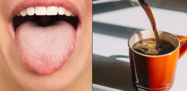 این نشانه روی زبان می‌گوید نباید قهوه بنوشید؛ رنگ‌های مختلف زبان نشانه چه مشکلاتی هستند؟