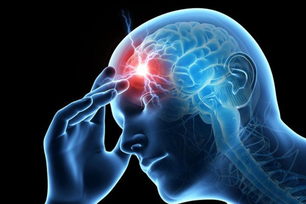 چه بخوریم که میگرن نگیریم؟ راهکارهای تغذیهای برای کنترل سردردهای میگرنی