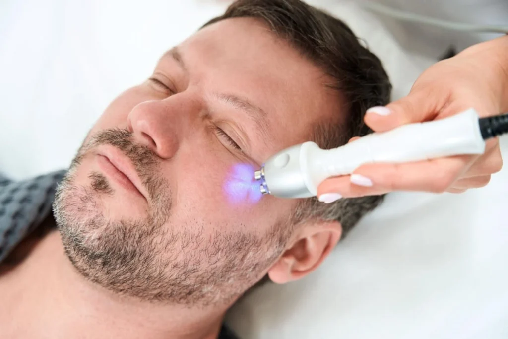سفت کردن پوست با رادیو فرکانسی (RF) چیست و چه مزایایی دارد؟