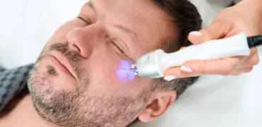 سفت کردن پوست با رادیو فرکانسی (RF) چیست و چه مزایایی دارد؟
