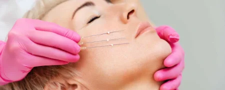 لیفت با نخ؛ روشی نوین برای جوان‌سازی بدون جراحی