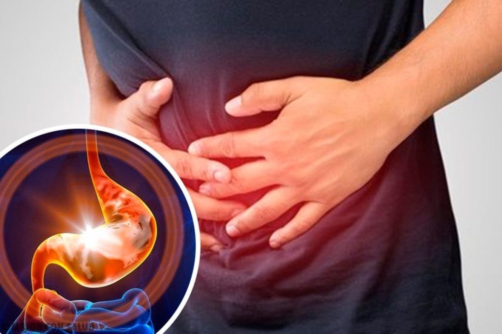 ورم معده چیست و چرا نباید علائم آن را نادیده گرفت؟ بررسی علل، درمان و پیشگیری