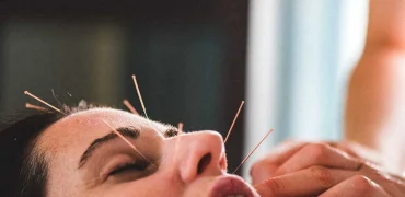 طب سوزنی صورت؛ روشی طبیعی برای جوان‌سازی پوست