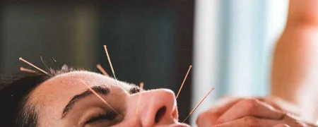 طب سوزنی صورت؛ روشی طبیعی برای جوان‌سازی پوست