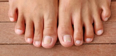 هر آنچه که ناخن‌های پا در مورد سلامتی به ما می‌گویند؛ از تغییر رنگ و شکل تا بیماری!