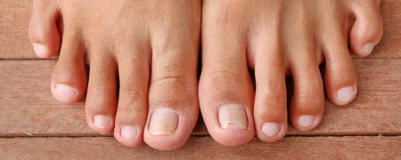 هر آنچه که ناخن‌های پا در مورد سلامتی به ما می‌گویند؛ از تغییر رنگ و شکل تا بیماری!