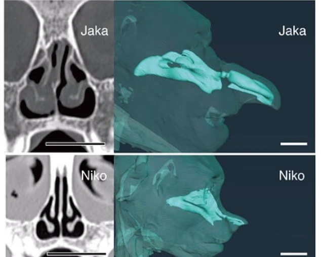 سیتی اسکن دماغ میمونهای بینی دراز