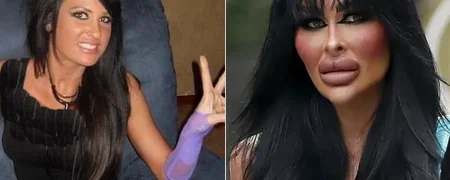 ظاهر جدید باربی واقعی استرالیایی که ۲۰۰,۰۰۰ دلار صرف جراحی زیبایی کرده است
