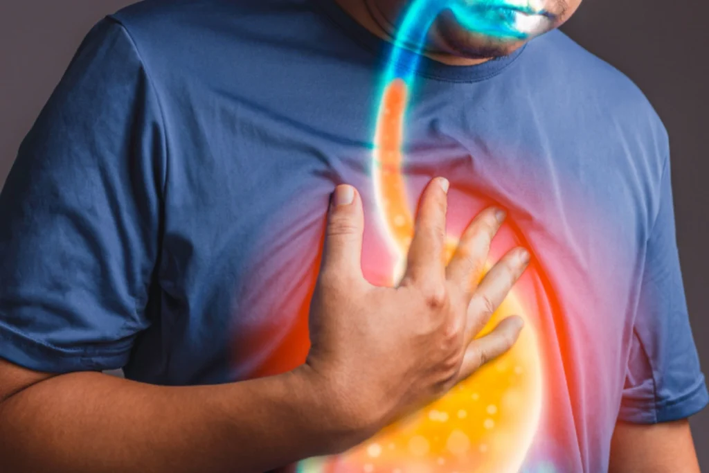 تجربه یک بیمار از ۲۰ سال زندگی با ریفلاکس معده و آنچه پشت این بیماری است