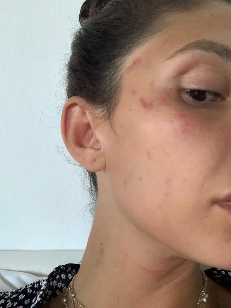 سارا بلوما