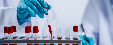 ۴ نوع آزمایش خون حیاتی که هر کسی بعد از ۴۰ سالگی باید انجام دهد