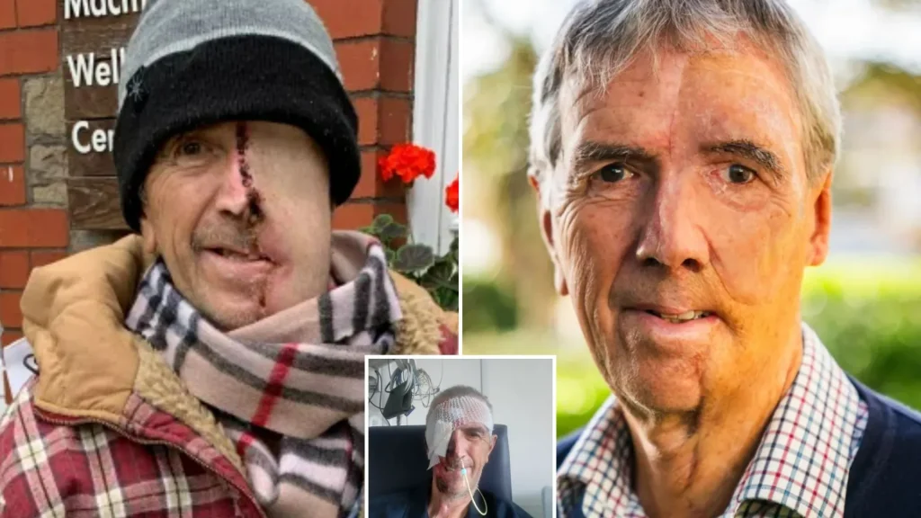 بازسازی صورت مردی ۷۵ ساله با فناوری چاپ سهبعدی پس از سانحه تصادف + ویدیو