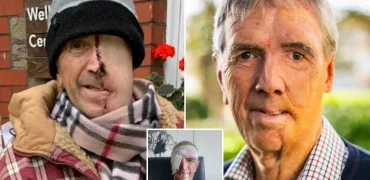 بازسازی صورت مردی ۷۵ ساله با فناوری چاپ سه‌بعدی پس از سانحه تصادف + ویدیو