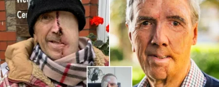 بازسازی صورت مردی ۷۵ ساله با فناوری چاپ سه‌بعدی پس از سانحه تصادف + ویدیو