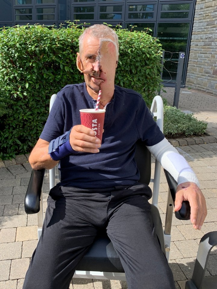 چاپ سهبعدی صورت