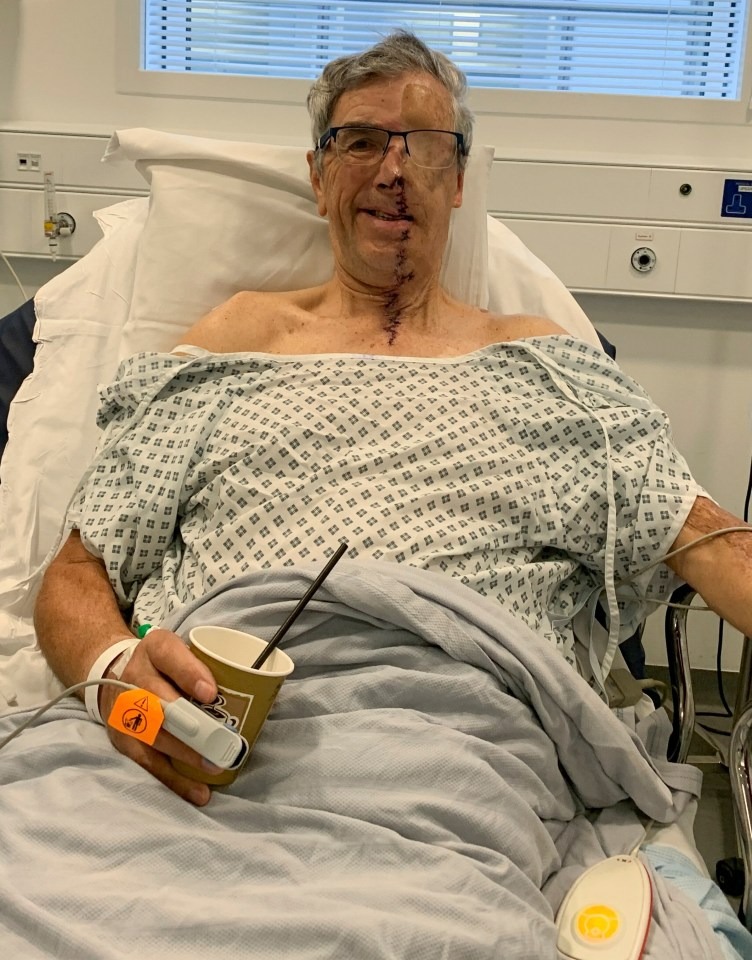 چاپ سهبعدی صورت