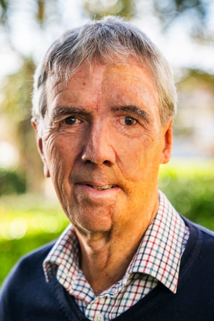 چاپ سهبعدی صورت