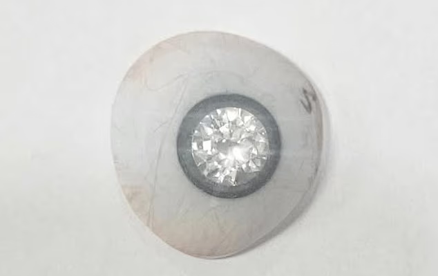 پروتز چشم الماسی