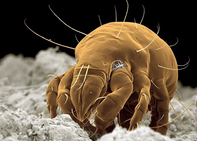 مایت گرد و غبار زیر میکروسکوپ