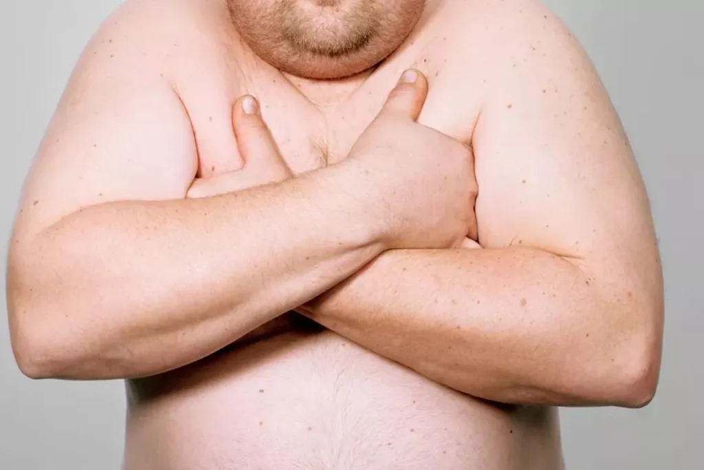 چگونه از شر «پستانهای مردانه» خلاص شویم؛ دلایل اصلی و بهترین زمان مراجعه به پزشک