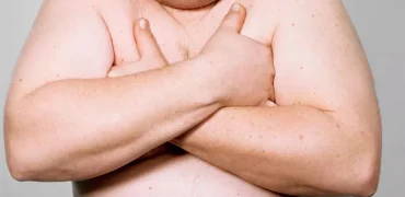 چگونه از شر «پستان‌های مردانه» خلاص شویم؛ دلایل اصلی و بهترین زمان مراجعه به پزشک
