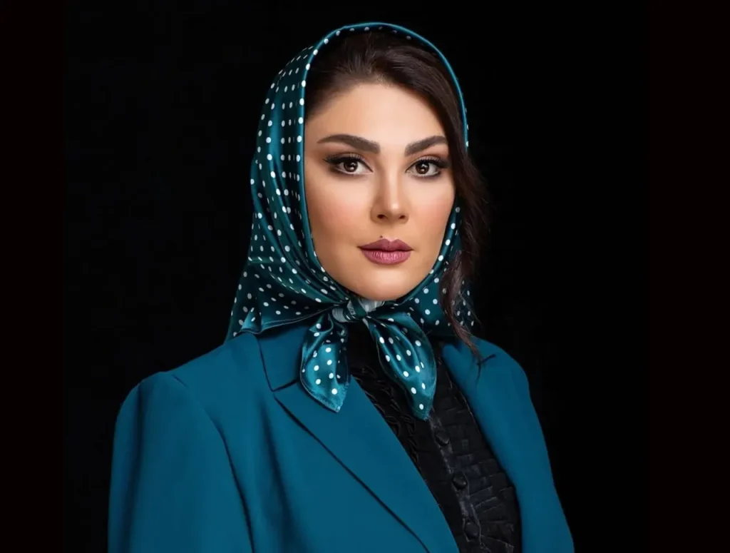 تغییر چهره لاله اسکندری بعد از عمل زیبایی مورد توجه قرار گرفت + ویدیو