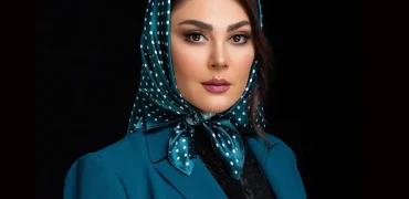 تغییر چهره لاله اسکندری بعد از عمل زیبایی مورد توجه قرار گرفت + ویدیو