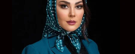 تغییر چهره لاله اسکندری بعد از عمل زیبایی مورد توجه قرار گرفت + ویدیو