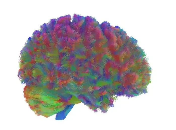 تغییر ساختار مغز انسان