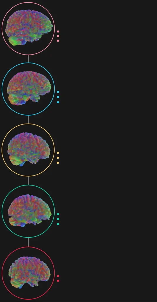 تغییر ساختار مغز انسان