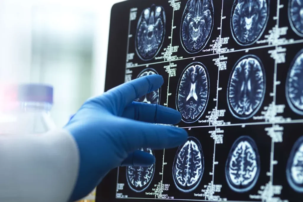 ۴ مرحله اصلی رشد مغز انسان؛ انسان‌ها تا ۳۲ سالگی «مثل نوجوان‌ها» فکر می‌کنند!