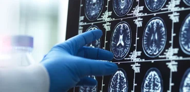 ۴ مرحله اصلی رشد مغز انسان؛ انسان‌ها تا ۳۲ سالگی «مثل نوجوان‌ها» فکر می‌کنند!