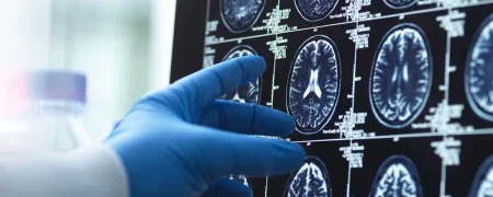 ۴ مرحله اصلی رشد مغز انسان؛ انسان‌ها تا ۳۲ سالگی «مثل نوجوان‌ها» فکر می‌کنند!