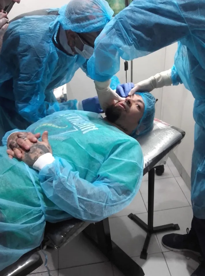 پروسه تتوی چشم