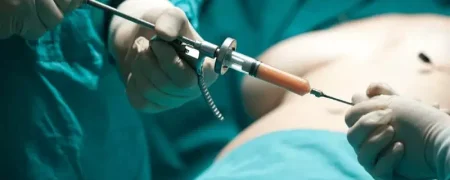 موج پشیمانی از عمل لیفت باسن برزیلی؛ چرا BBL پرریسک‌ترین جراحی ۲۰۲۵ شد؟