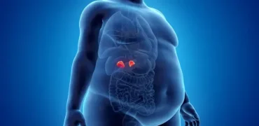 از «صورت ماه» تا «قوز بوفالو»: نشانه‌های آشکار و پنهان سندرم کوشینگ