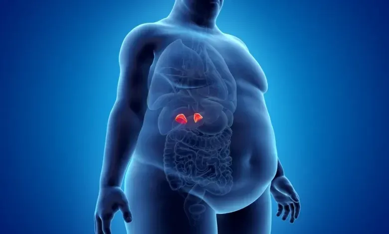 از «صورت ماه» تا «قوز بوفالو»: نشانه‌های آشکار و پنهان سندرم کوشینگ