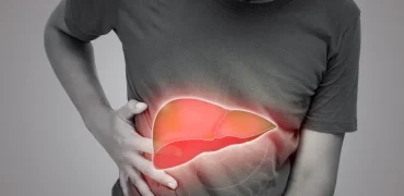 علل، علائم، روش‌های تشخیص و درمان سیروز کبدی چیست؟