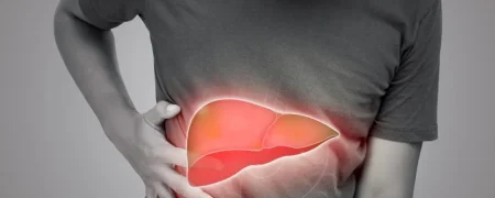 علل، علائم، روش‌های تشخیص و درمان سیروز کبدی چیست؟