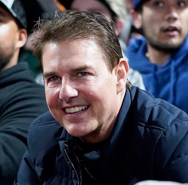 تام کروز پس از جراحی زیبایی