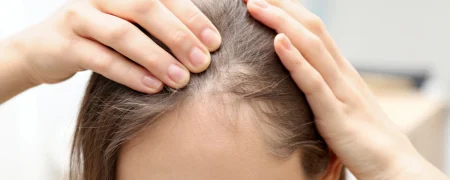 هشدار متخصصان درباره مدل‌ موی ترندی که باعث طاسی زنان می‌شود