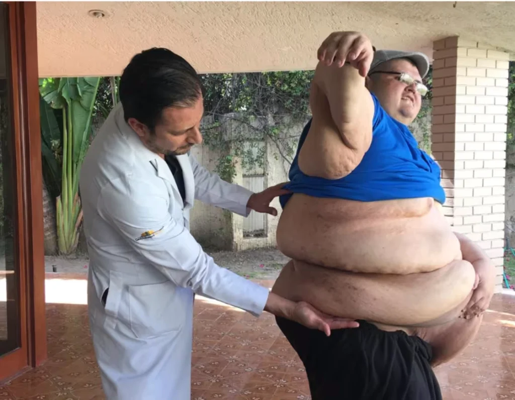 خوآن پدرو فرانکو چاق ترین مرد جهان در رکورد گینس