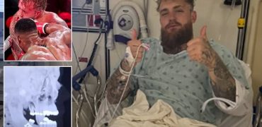 ژست میلیونی جیک پاول پس از شکست سنگین در برابر آنتونی جاشوا و جراحی فک