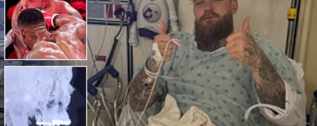 ژست میلیونی جیک پاول پس از شکست سنگین در برابر آنتونی جاشوا و جراحی فک