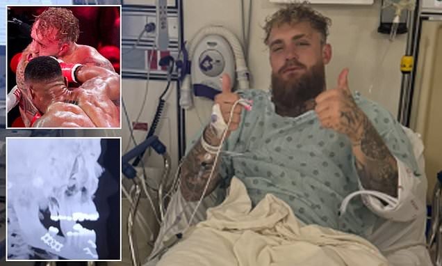 ژست میلیونی جیک پاول پس از شکست سنگین در برابر آنتونی جاشوا و جراحی فک