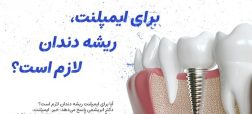آیا برای ایمپلنت، ریشه دندان لازم است؟