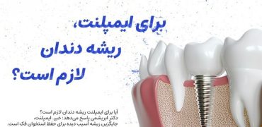 آیا برای ایمپلنت، ریشه دندان لازم است؟