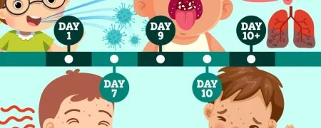 روند زمانی علائم مُسری‌ترین بیماری جهان؛ کودکان زیر ۵ سال در خطر ابتلا به سرخک