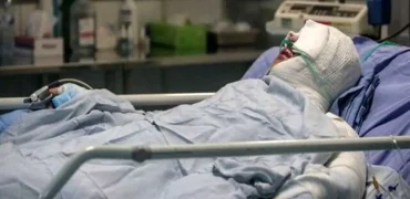 جنجال دوباره پرونده‌های اسیدپاشی زنان بی‌حجاب؛ مرور حوادث تلخ از دهه ۶۰ تا ۹۰