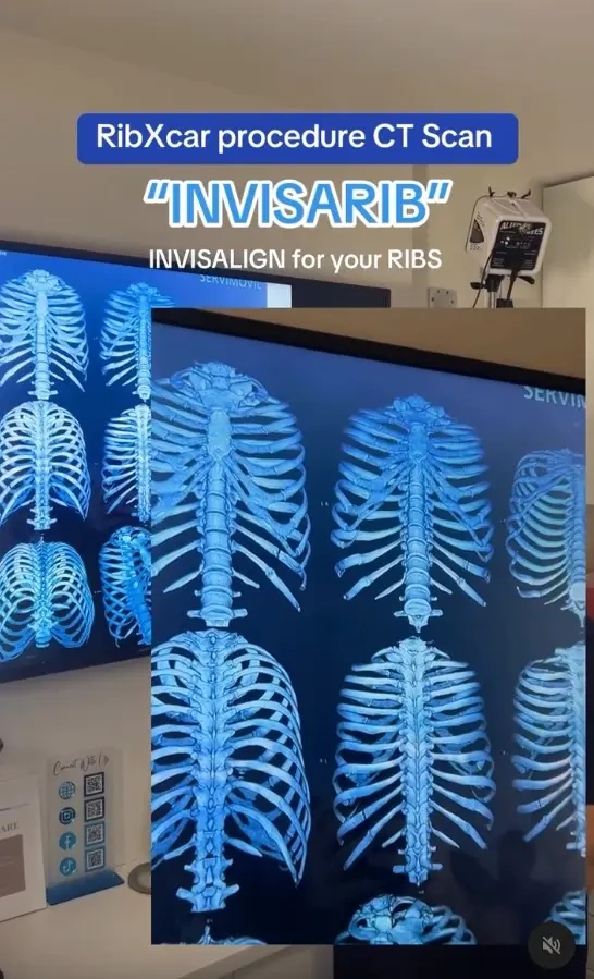 عمل بازسازی دنده